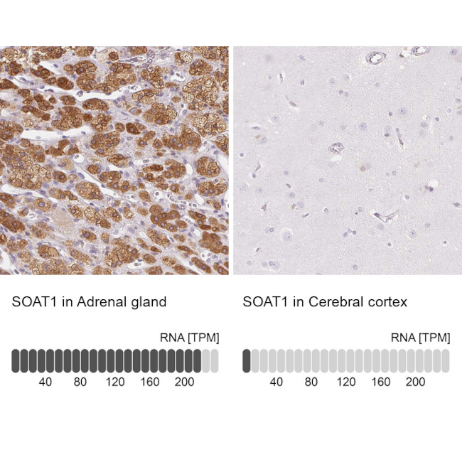 SOAT1 Antibody