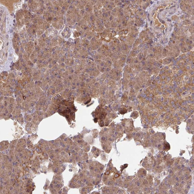 MRRF Antibody in Immunohistochemistry (IHC)