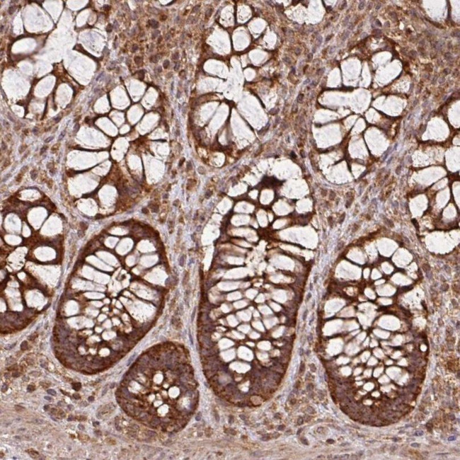 MRRF Antibody in Immunohistochemistry (IHC)