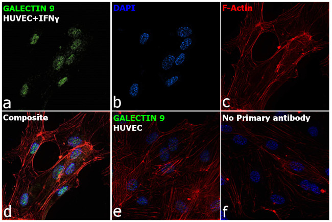 Galectin 9 Antibody in Immunocytochemistry (ICC/IF)