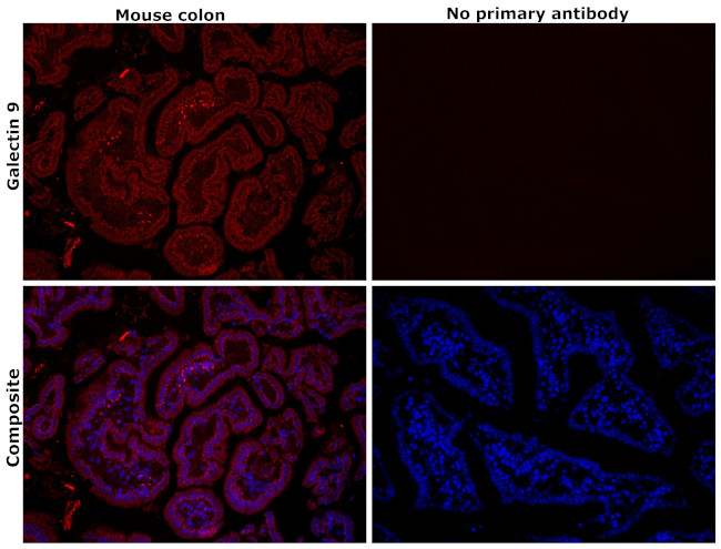 Galectin 9 Antibody in Immunohistochemistry (Paraffin) (IHC (P))