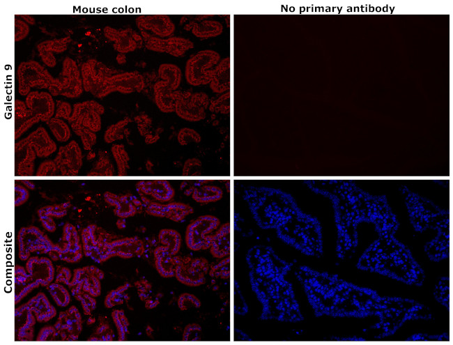 Galectin 9 Antibody in Immunohistochemistry (Paraffin) (IHC (P))