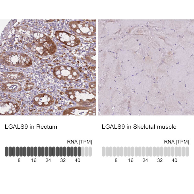 Galectin 9 Antibody in Immunohistochemistry (IHC)