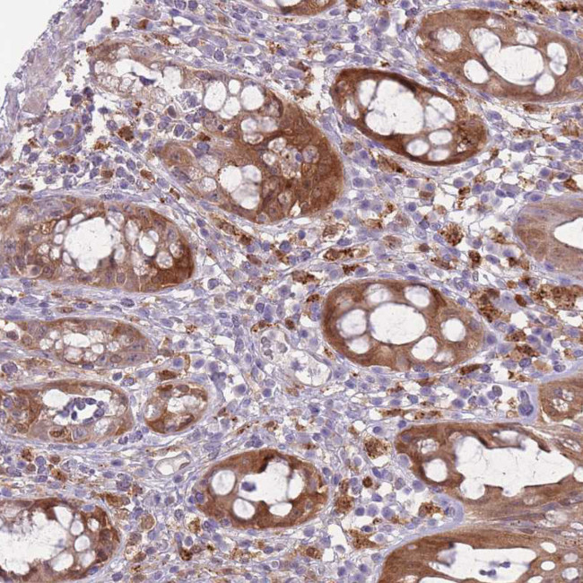 Galectin 9 Antibody in Immunohistochemistry (IHC)