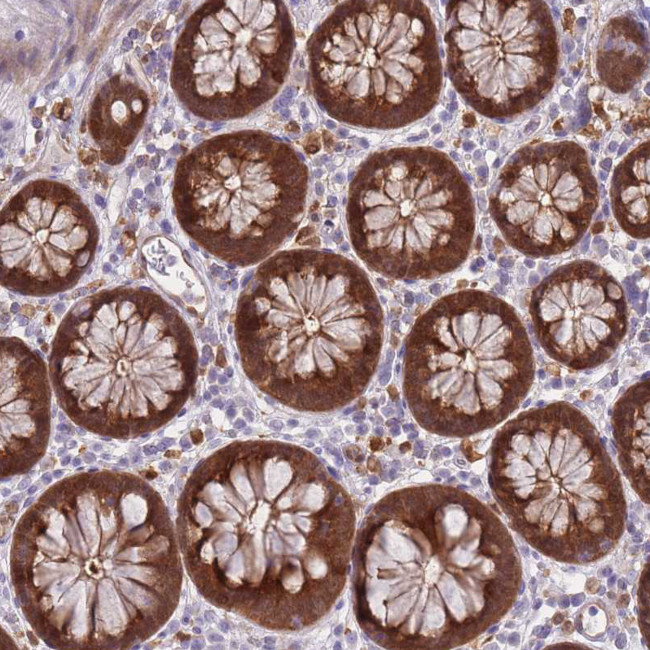 Galectin 9 Antibody in Immunohistochemistry (IHC)