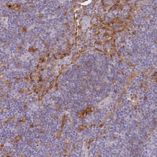 Galectin 9 Antibody in Immunohistochemistry (IHC)