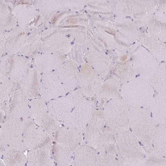 Galectin 9 Antibody in Immunohistochemistry (IHC)