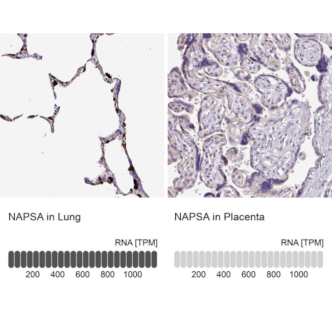 NAPSA Antibody in Immunohistochemistry (IHC)