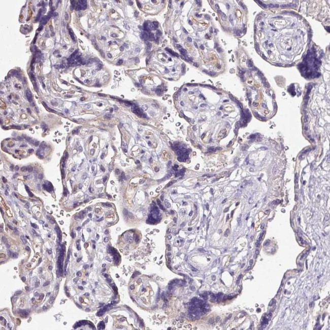 NAPSA Antibody in Immunohistochemistry (IHC)