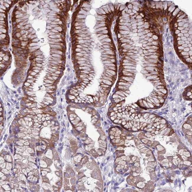 SLC44A3 Antibody in Immunohistochemistry (IHC)