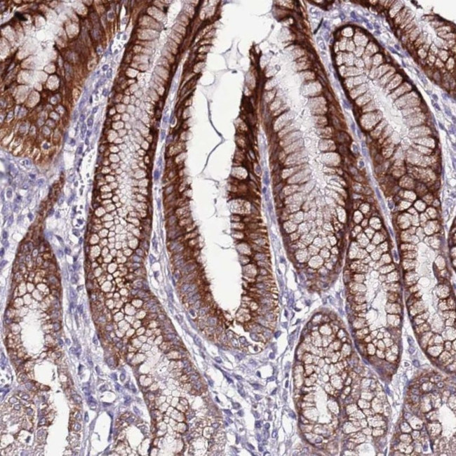 SLC44A3 Antibody in Immunohistochemistry (IHC)