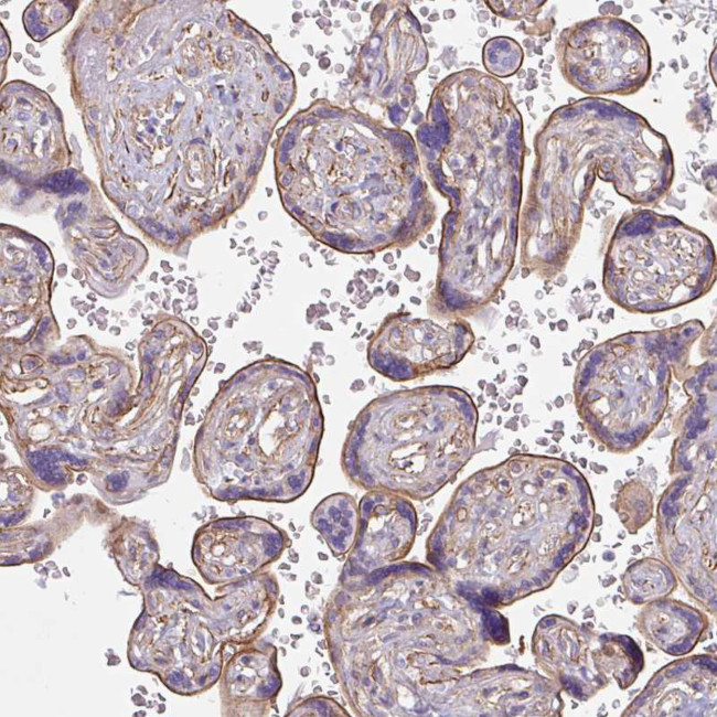 MYH10 Antibody in Immunohistochemistry (IHC)