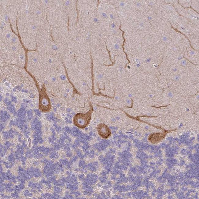 MYH10 Antibody in Immunohistochemistry (IHC)