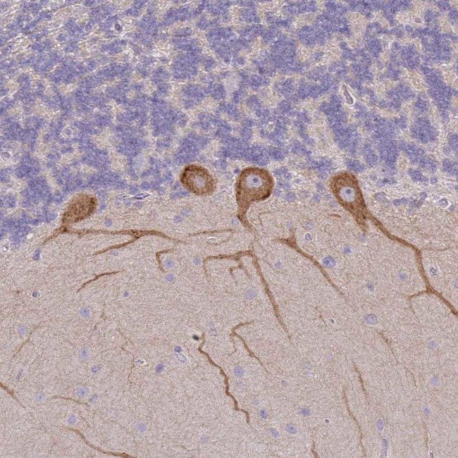 MYH10 Antibody in Immunohistochemistry (IHC)