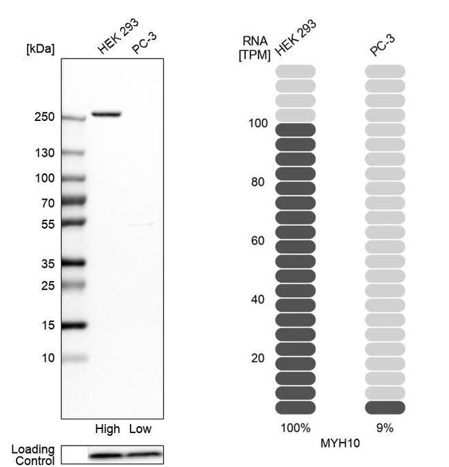 MYH10 Antibody in Western Blot (WB)