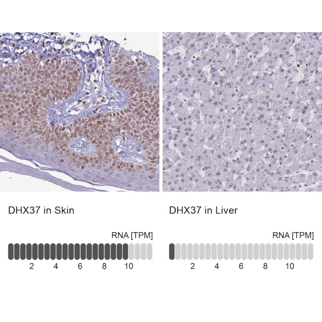 DHX37 Antibody in Immunohistochemistry (IHC)