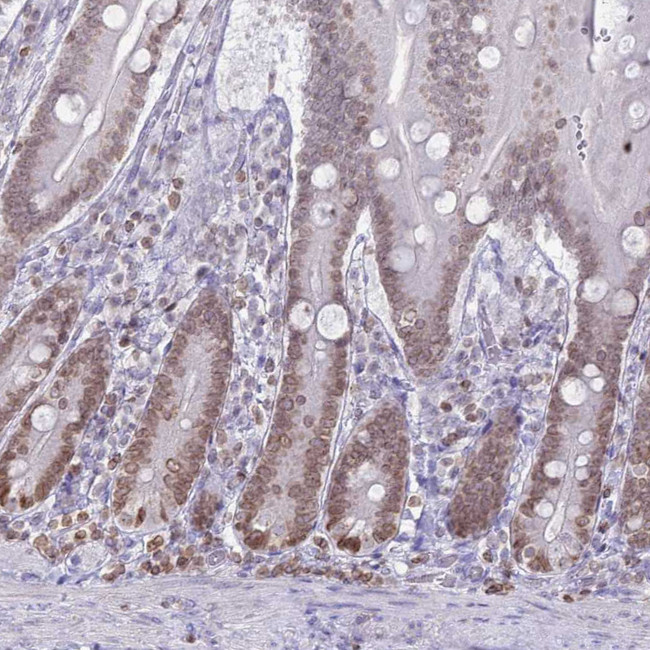 DHX37 Antibody in Immunohistochemistry (IHC)