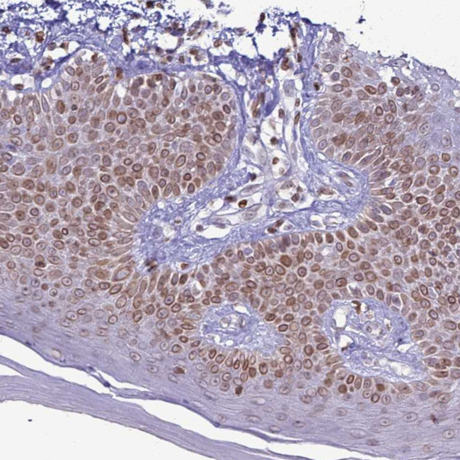 DHX37 Antibody in Immunohistochemistry (IHC)