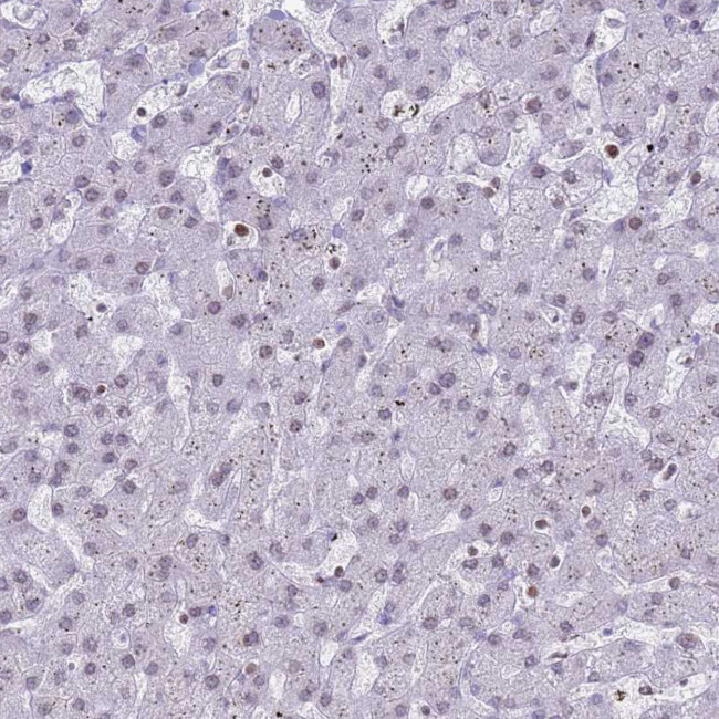 DHX37 Antibody in Immunohistochemistry (IHC)