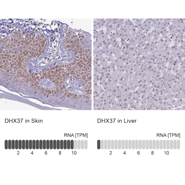 DHX37 Antibody