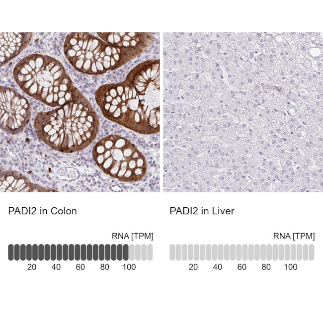 PADI2 Antibody in Immunohistochemistry (IHC)