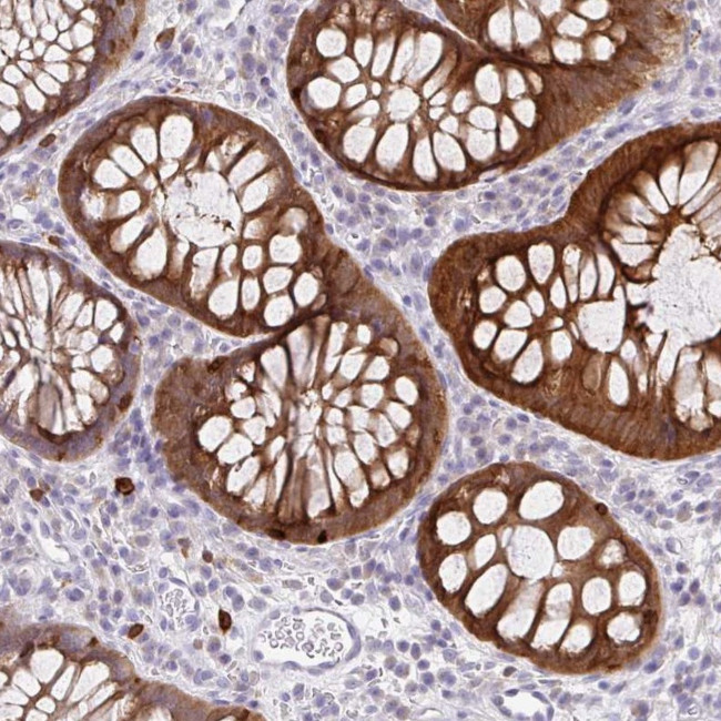 PADI2 Antibody in Immunohistochemistry (IHC)