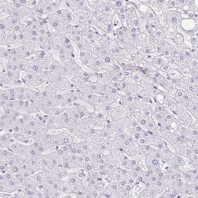 PADI2 Antibody in Immunohistochemistry (IHC)