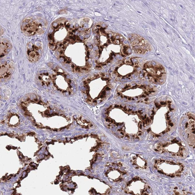 B4GALT2 Antibody in Immunohistochemistry (IHC)