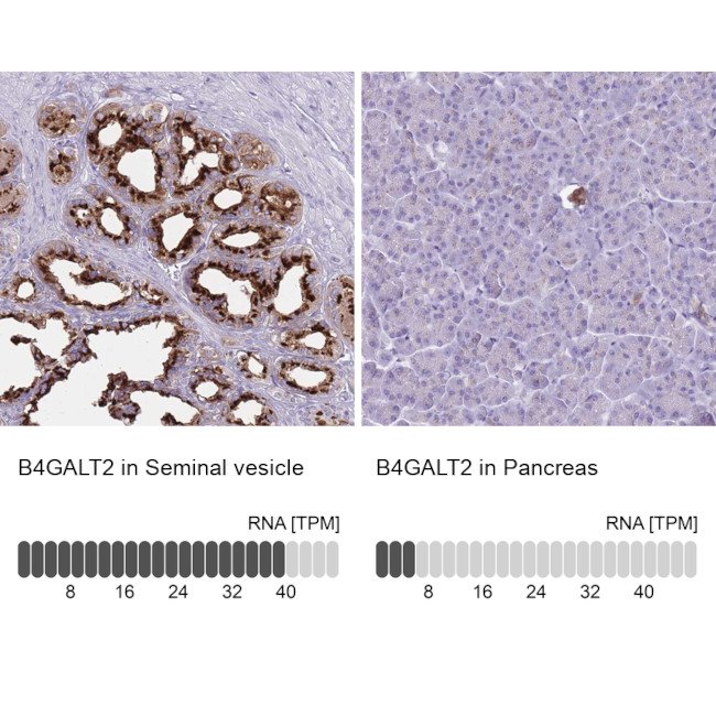 B4GALT2 Antibody