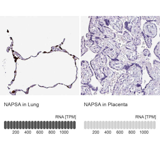 NAPSA Antibody in Immunohistochemistry (IHC)