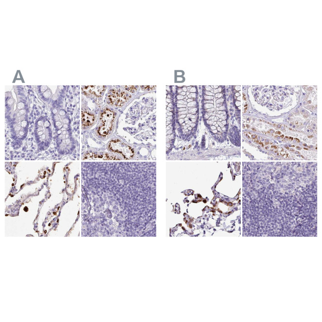 NAPSA Antibody in Immunohistochemistry (IHC)