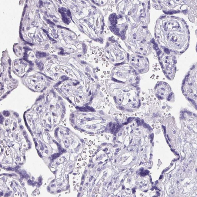 NAPSA Antibody in Immunohistochemistry (IHC)