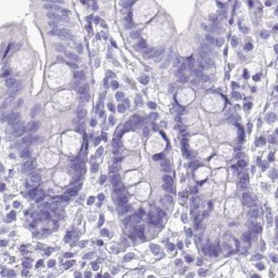 NAPSA Antibody in Immunohistochemistry (IHC)