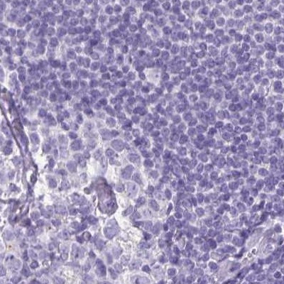 NAPSA Antibody in Immunohistochemistry (IHC)