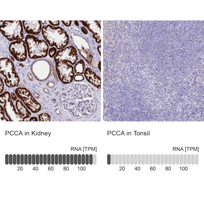 PCCA Antibody in Immunohistochemistry (IHC)