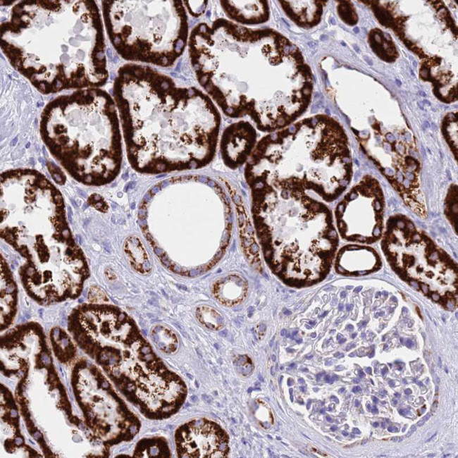 PCCA Antibody in Immunohistochemistry (IHC)