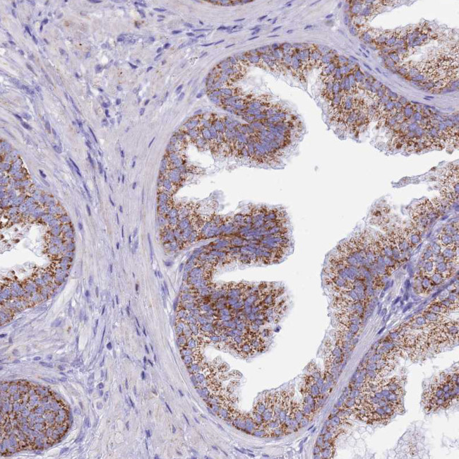 PCCA Antibody in Immunohistochemistry (IHC)