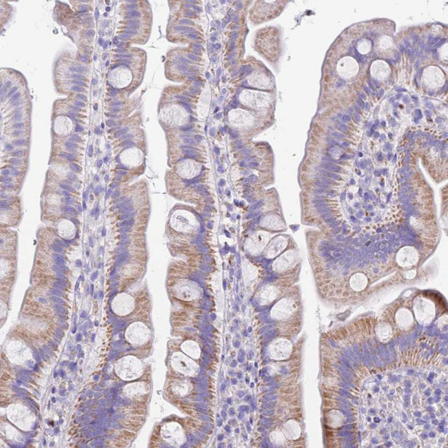 PCCA Antibody in Immunohistochemistry (IHC)