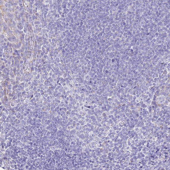 PCCA Antibody in Immunohistochemistry (IHC)