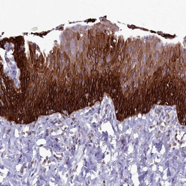 RAC1/RAC2/RAC3 Antibody in Immunohistochemistry (IHC)