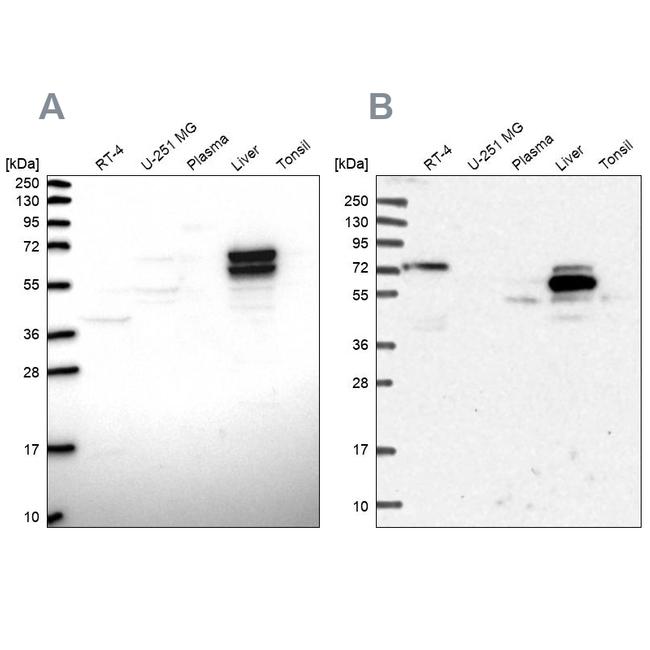 ACSS3 Antibody in Western Blot (WB)