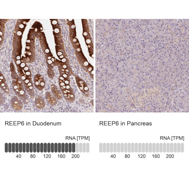 REEP6 Antibody