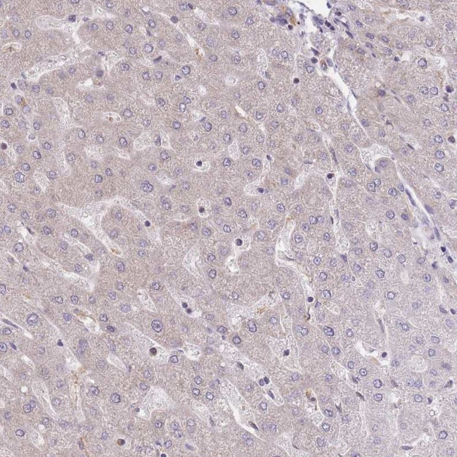 eIF2b beta Antibody in Immunohistochemistry (IHC)