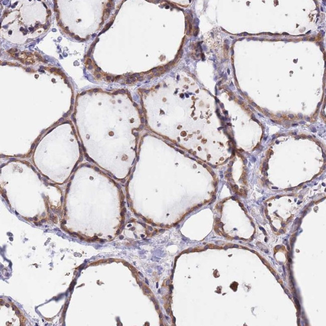 eIF2b beta Antibody in Immunohistochemistry (IHC)