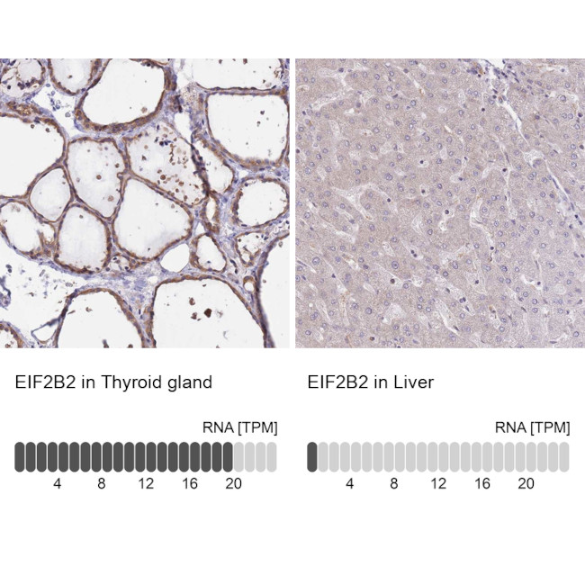 eIF2b beta Antibody