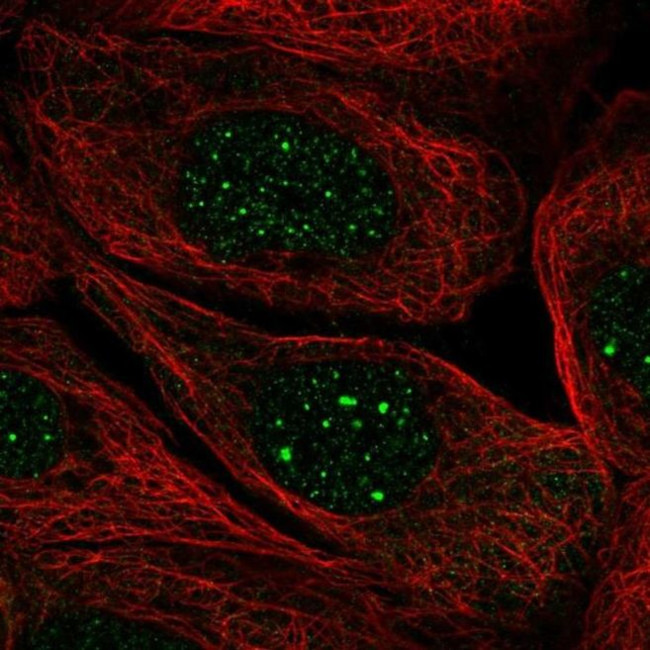 SIRPB2 Antibody in Immunocytochemistry (ICC/IF)