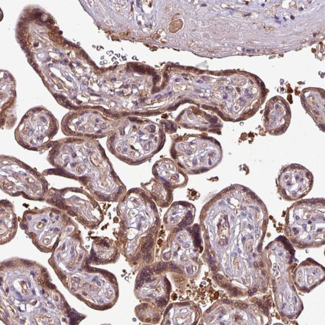 SIRPB2 Antibody in Immunohistochemistry (IHC)