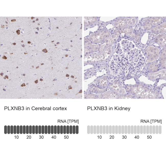 PLXNB3 Antibody in Immunohistochemistry (IHC)