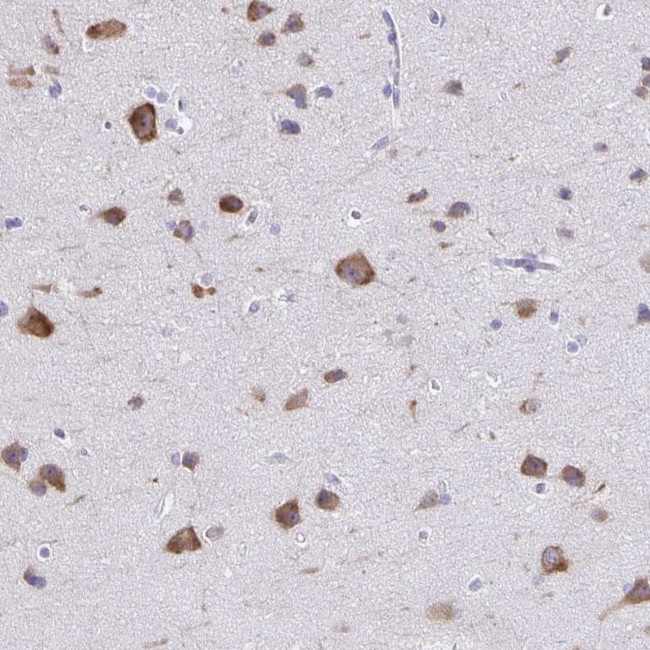 PLXNB3 Antibody in Immunohistochemistry (IHC)