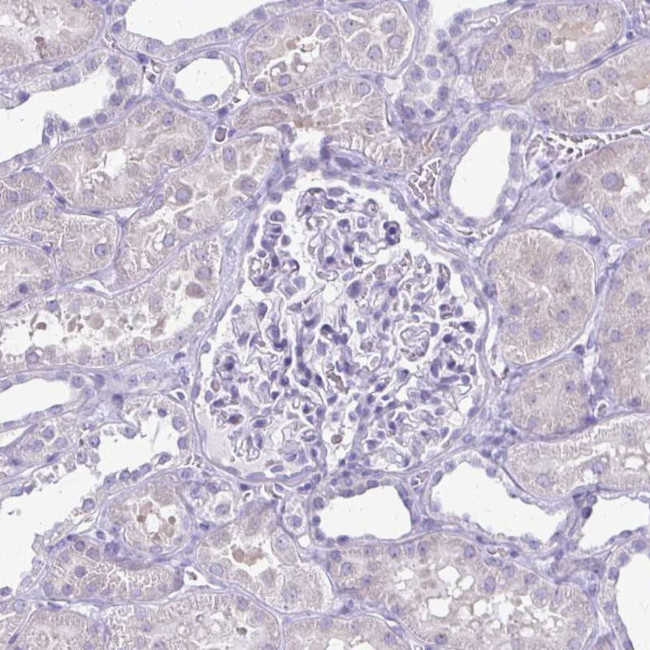 PLXNB3 Antibody in Immunohistochemistry (IHC)